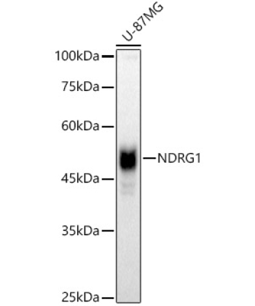 NDRG1 Rabbit Polyclonal Antibody [KO Validated]