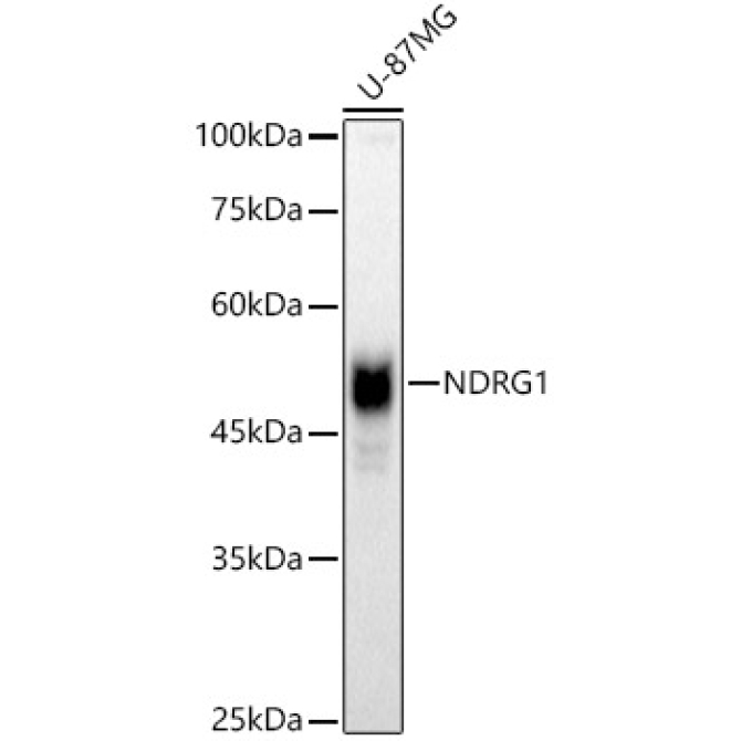 NDRG1 Rabbit Polyclonal Antibody [KO Validated]