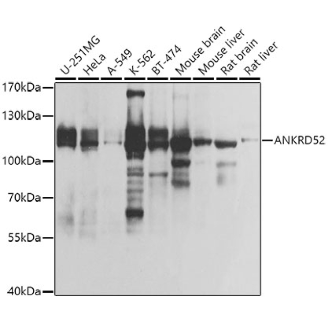 ANKRD52 Rabbit Polyclonal Antibody
