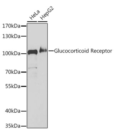 Glucocorticoid Receptor Rabbit Polyclonal Antibody