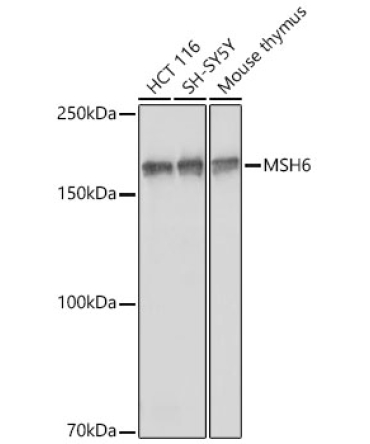 MSH6 Rabbit Polyclonal Antibody [KO Validated]
