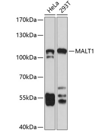 MALT1 Rabbit Polyclonal Antibody