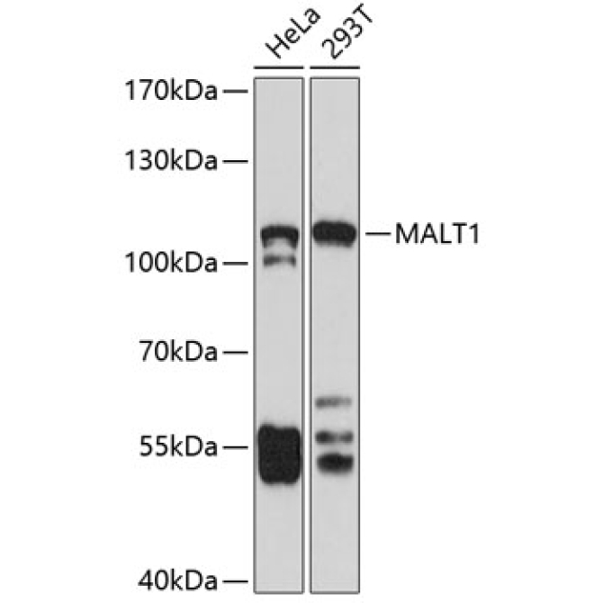 MALT1 Rabbit Polyclonal Antibody
