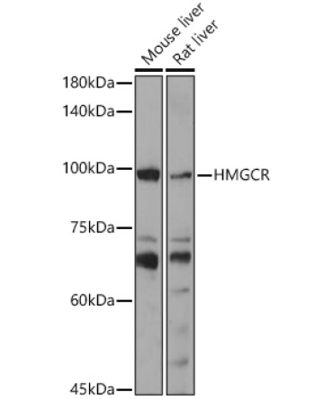HMGCR Rabbit Polyclonal Antibody