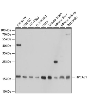 HPCAL1 Rabbit Polyclonal Antibody