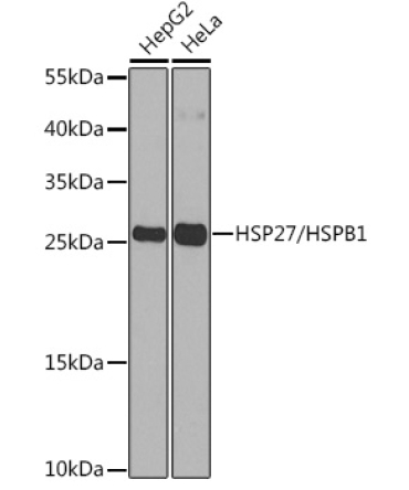 HSP27/HSPB1 Rabbit Polyclonal Antibody