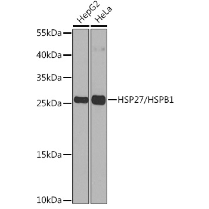 HSP27/HSPB1 Rabbit Polyclonal Antibody