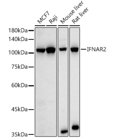 IFNAR2 Rabbit Polyclonal Antibody [KO Validated]