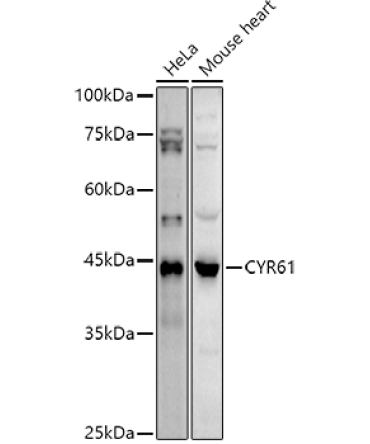 CYR61 Rabbit Polyclonal Antibody