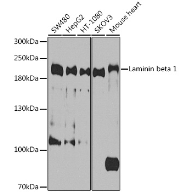 Laminin beta 1 Rabbit Polyclonal Antibody