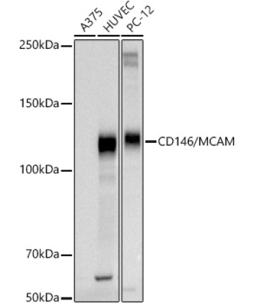 CD146/MCAM Rabbit Polyclonal Antibody