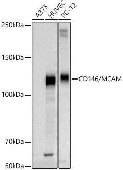 CD146/MCAM Rabbit Polyclonal Antibody