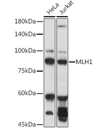 MLH1 Rabbit Polyclonal Antibody