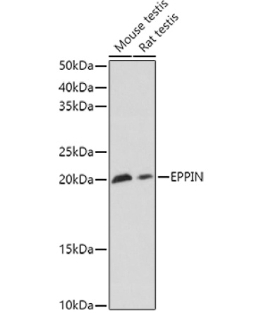 EPPIN Rabbit Polyclonal Antibody