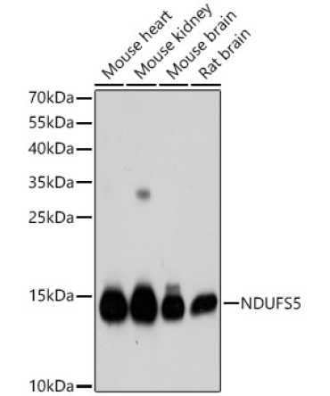 NDUFS5 Rabbit Polyclonal Antibody [KD Validated]