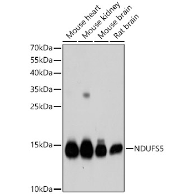 NDUFS5 Rabbit Polyclonal Antibody [KD Validated]