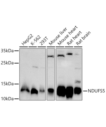 NDUFS5 Rabbit Polyclonal Antibody