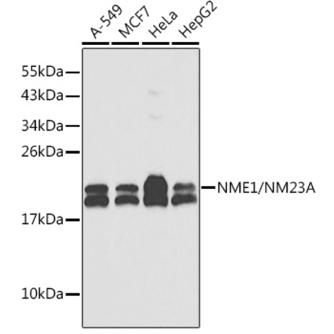 NME1/NM23A Rabbit Polyclonal Antibody