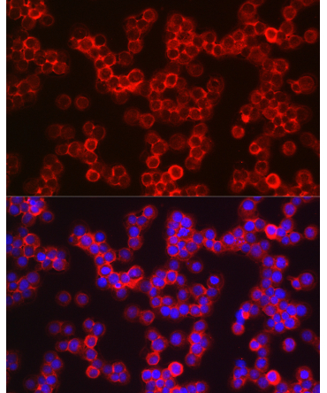 Notch1 Rabbit Polyclonal Antibody
