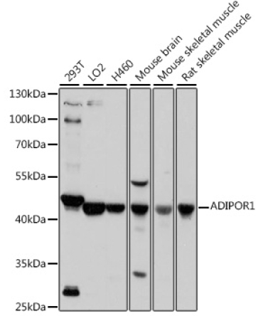 ADIPOR1 Rabbit Polyclonal Antibody