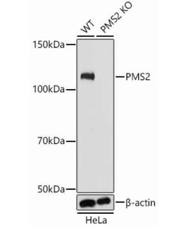 PMS2 Rabbit Polyclonal Antibody [KO Validated]