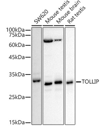 TOLLIP Rabbit Polyclonal Antibody [KD Validated]