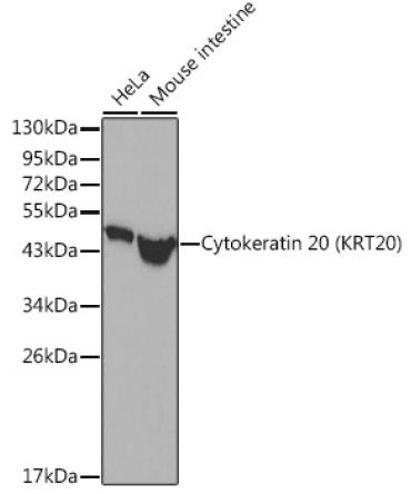 Cytokeratin 20 (KRT20) Rabbit Polyclonal Antibody