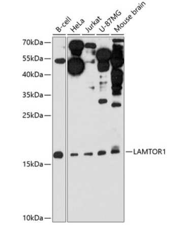 LAMTOR1 Rabbit Polyclonal Antibody