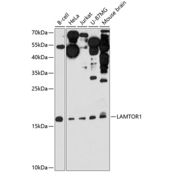 LAMTOR1 Rabbit Polyclonal Antibody