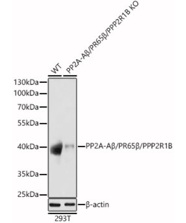PP2A-ABeta/PR65Beta/PPP2R1B Rabbit Polyclonal Antibody [KO Validated]
