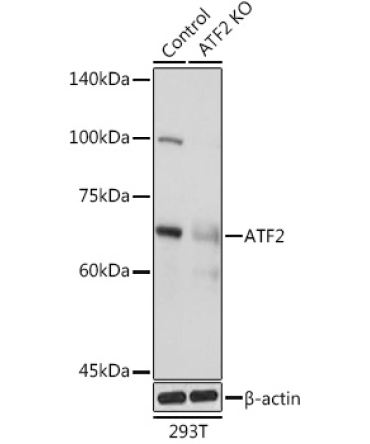 ATF2 Rabbit Polyclonal Antibody [KO Validated]