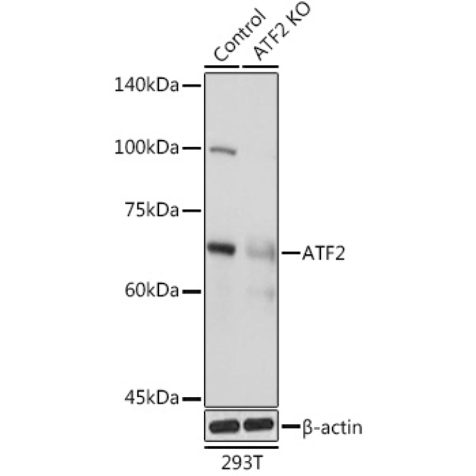 ATF2 Rabbit Polyclonal Antibody [KO Validated]