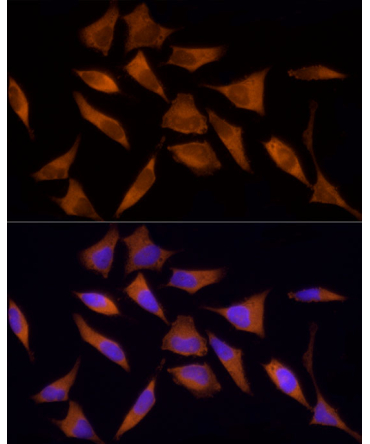 AMPKAlpha1 Rabbit Polyclonal Antibody