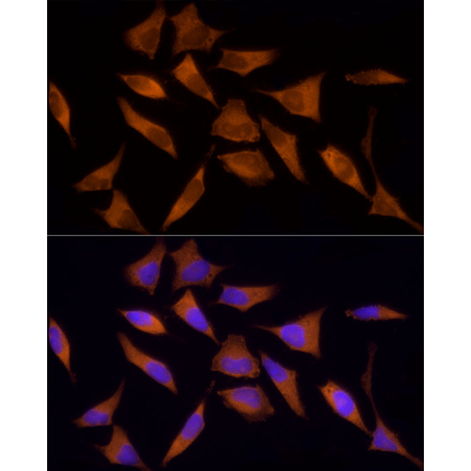 AMPKAlpha1 Rabbit Polyclonal Antibody