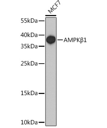 AMPKBeta1 Rabbit Polyclonal Antibody
