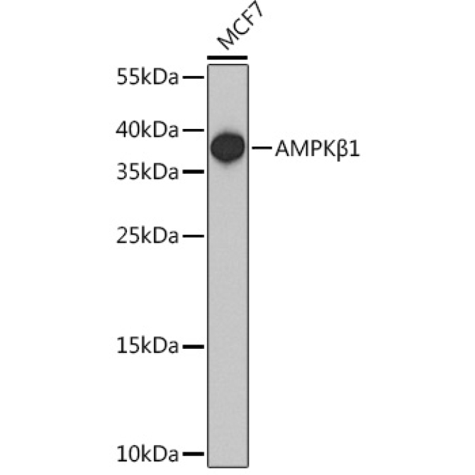 AMPKBeta1 Rabbit Polyclonal Antibody