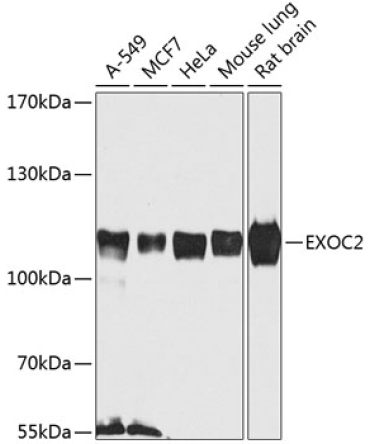 EXOC2 Rabbit Polyclonal Antibody