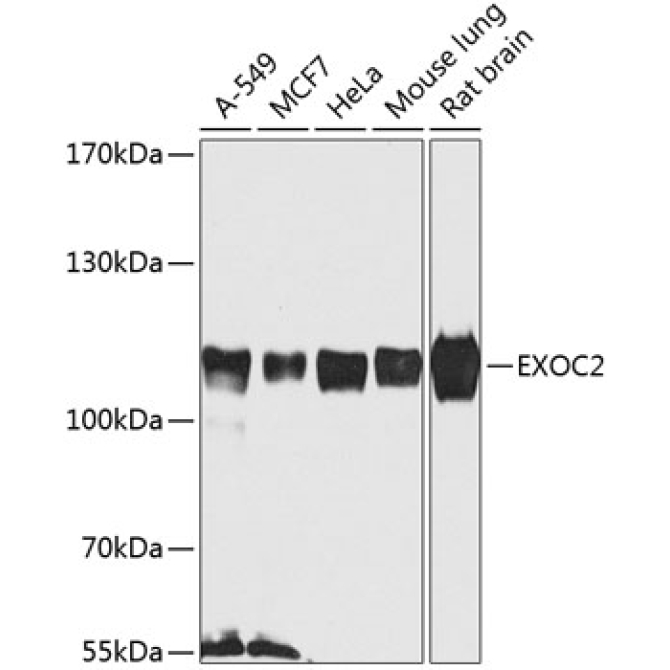 EXOC2 Rabbit Polyclonal Antibody