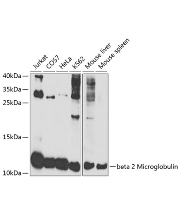 beta 2 Microglobulin Rabbit Polyclonal Antibody