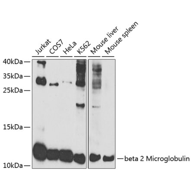 beta 2 Microglobulin Rabbit Polyclonal Antibody