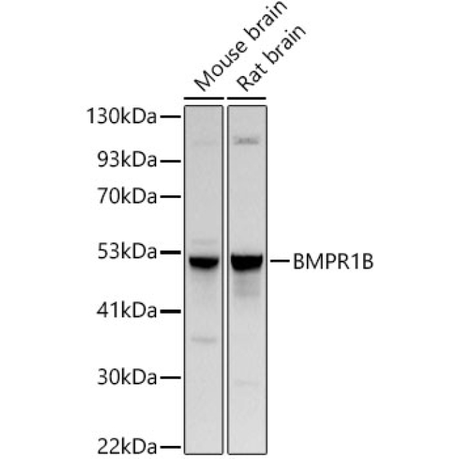 BMPR1B Rabbit Polyclonal Antibody