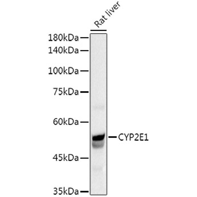 CYP2E1 Rabbit Polyclonal Antibody