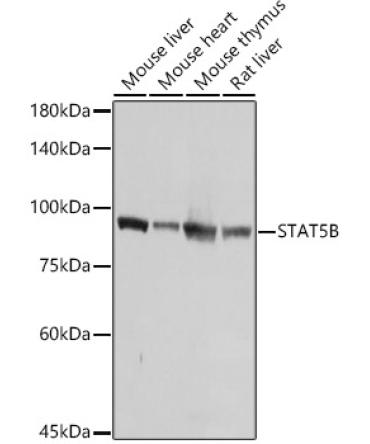 STAT5B Rabbit Polyclonal Antibody [KO Validated]