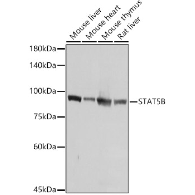STAT5B Rabbit Polyclonal Antibody [KO Validated]