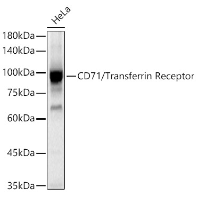 CD71/Transferrin Receptor Rabbit Polyclonal Antibody
