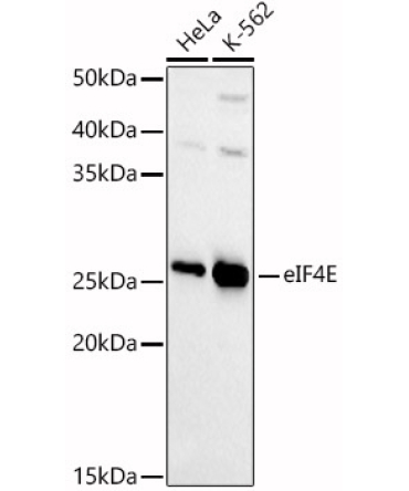 eIF4E Rabbit Polyclonal Antibody [KD Validated]