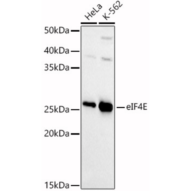 eIF4E Rabbit Polyclonal Antibody [KD Validated]