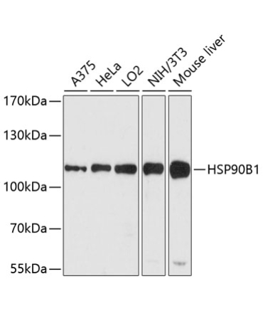 Grp94 Rabbit Polyclonal Antibody