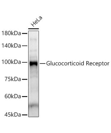 Glucocorticoid Receptor Rabbit Polyclonal Antibody