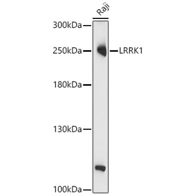 LRRK1 Rabbit Polyclonal Antibody